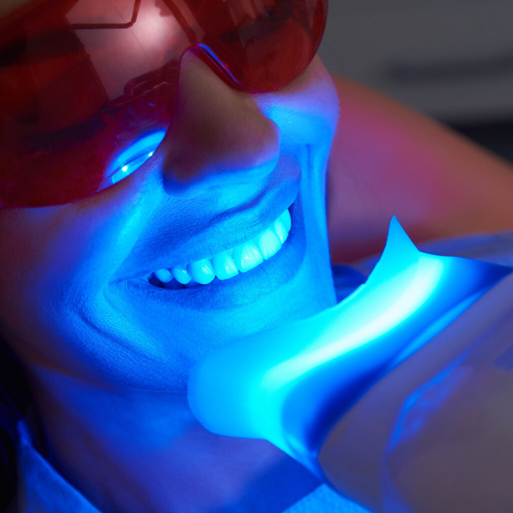 difference between teeth whitening and bleaching