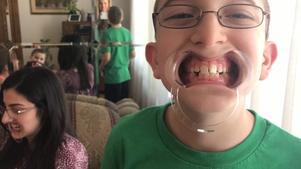 Watch Ya Mouth: The MouthGuard Game