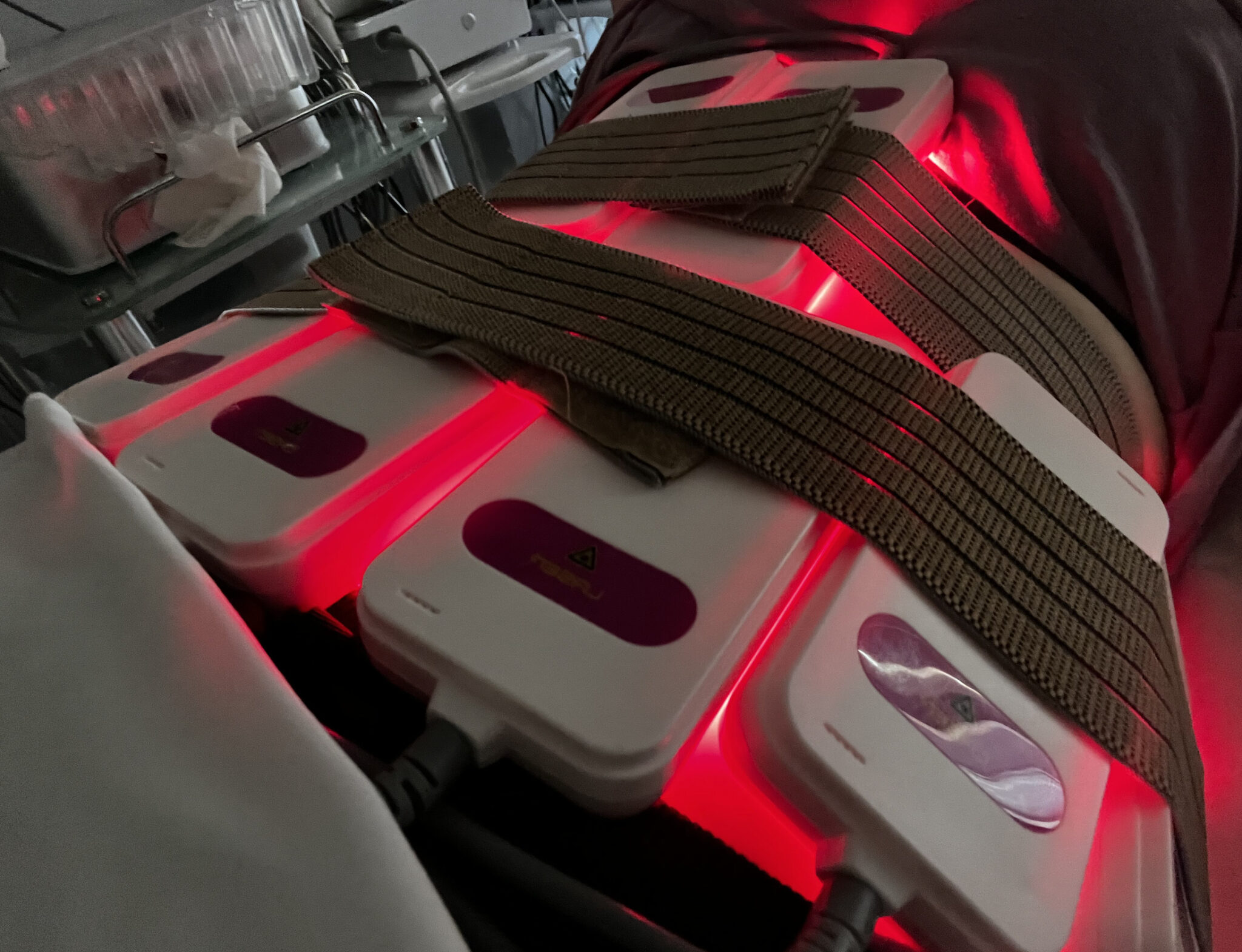 My Review Of Both Laser Lipo And Radio Frequency Assisted Cavitation Lipo