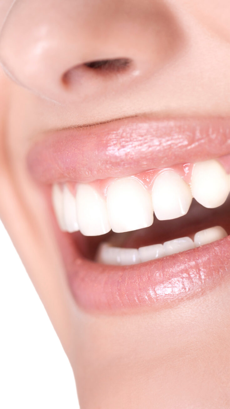 How To Deal With Teeth Sensitivity After Whitening